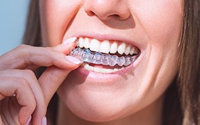 Nose-to-chin view of woman inserting her upper Invisalign tray