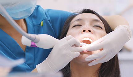 Scaling and root planing can be done in two appointments